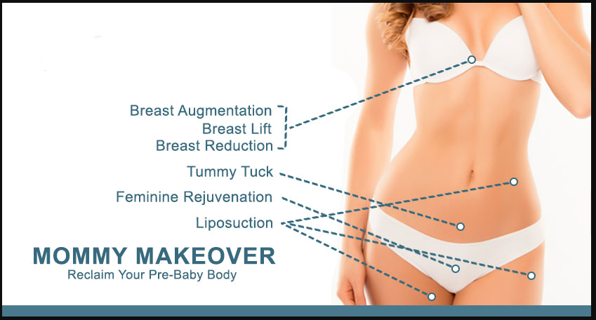 Mommy Makeover is a combination procedure that utilizes a variety of surgical procedures